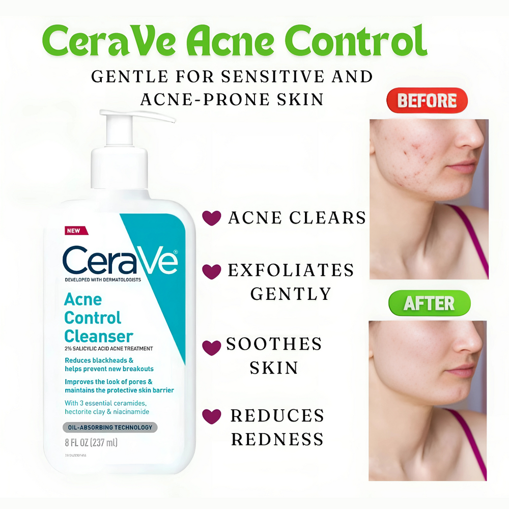 
                      
                        Cerave Acne Control Cleanser 237ml - Beauty Nest
                      
                    